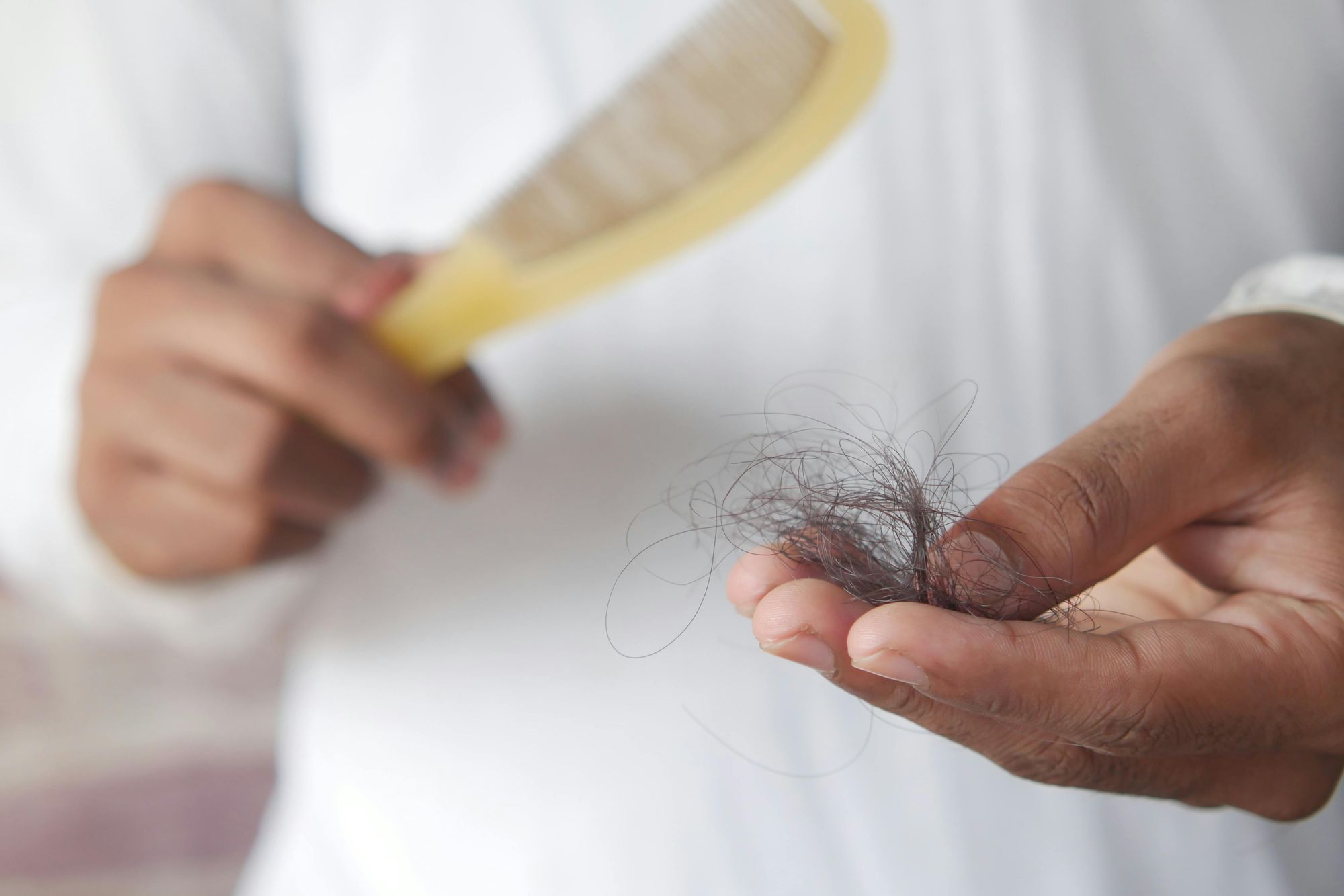 Perché cadono i capelli?